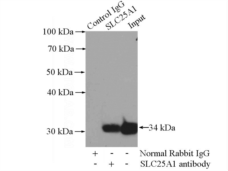 IP Result of anti-SLC25A1 (IP:Catalog No:115320, 2ug; Detection:Catalog No:115320 1:500) with HeLa cells lysate 2000ug.