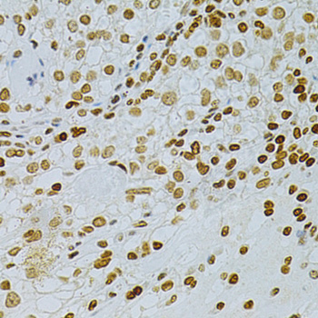 Immunohistochemistry - DKC1 Polyclonal Antibody 
