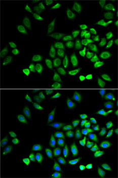 Immunofluorescence - ANGPTL4 Polyclonal Antibody 