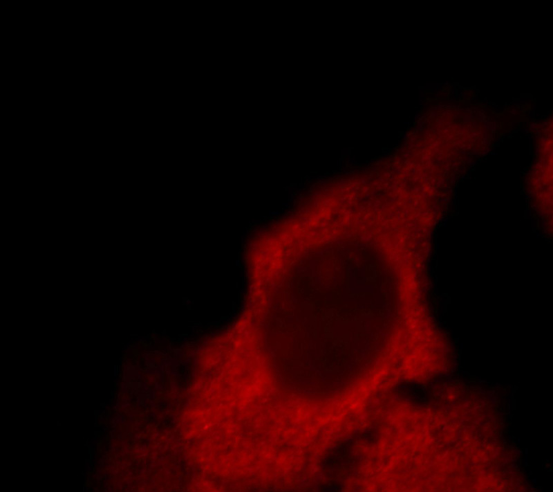 Immunofluorescent analysis of MCF-7 cells, using CAPZA1 antibody Catalog No: at 1:50 dilution and Rhodamine-labeled goat anti-mouse IgG (red).