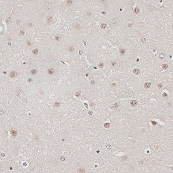 Immunohistochemistry - CBX6 Polyclonal Antibody 