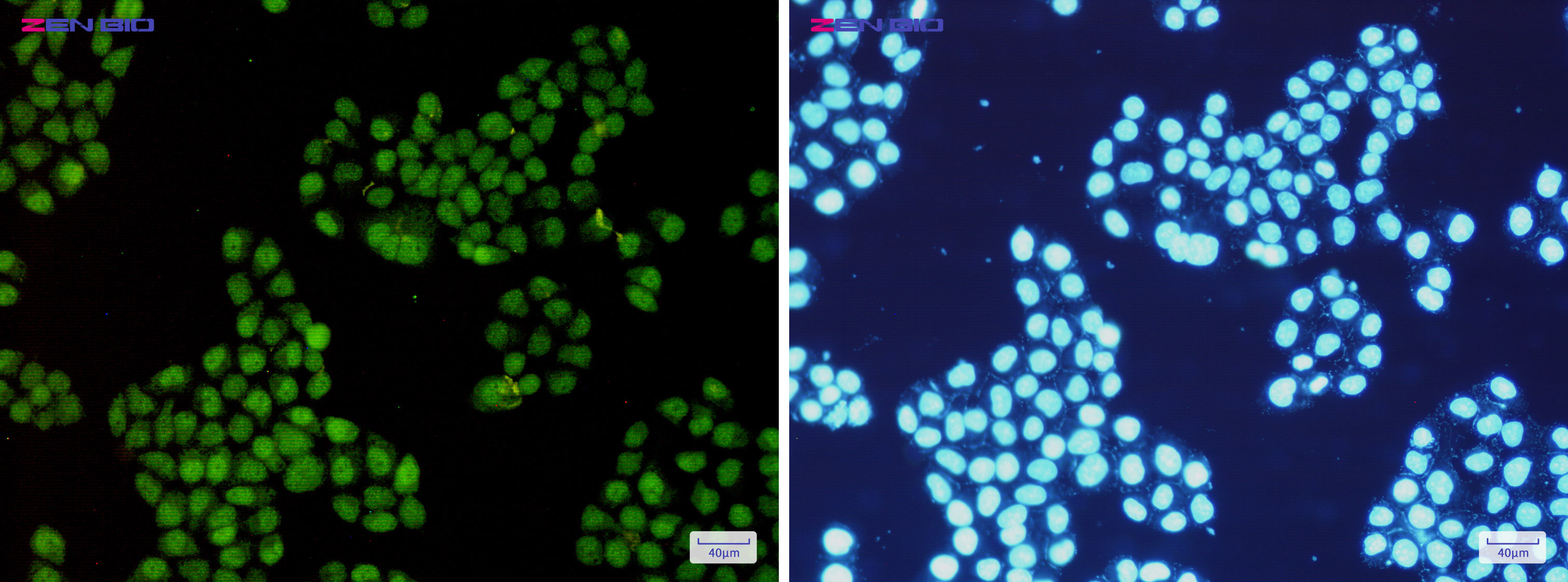 Immunocytochemistry of CDK2(green) in Hela cells using CDK2 Rabbit mAb at dilution 1/200, and DAPI(blue)