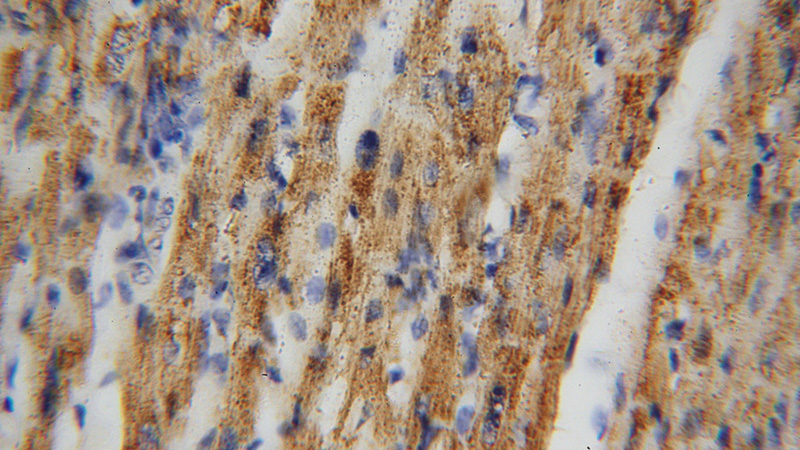 Immunohistochemical of paraffin-embedded human heart using Catalog No:109325(CS antibody) at dilution of 1:100 (under 40x lens)