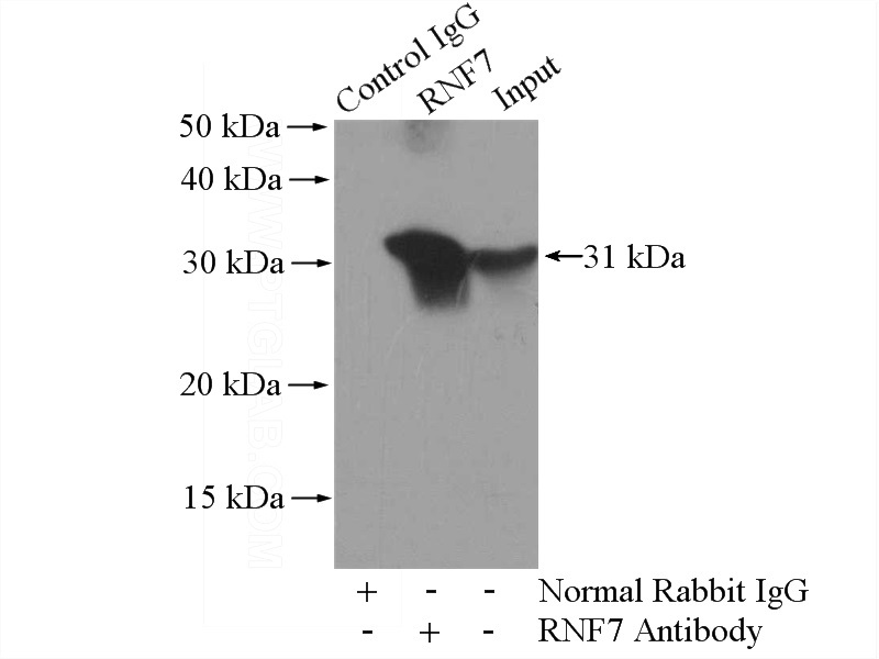 IP Result of anti-SAG (IP:Catalog No:114763, 4ug; Detection:Catalog No:114763 1:600) with mouse heart tissue lysate 4400ug.