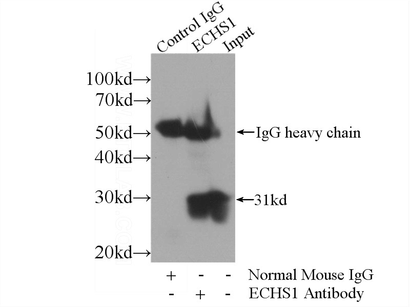 IP Result of anti-ECHS1 (IP:Catalog No:107245, 3ug; Detection:Catalog No:107245 1:1000) with HepG2 cells lysate 3600ug.