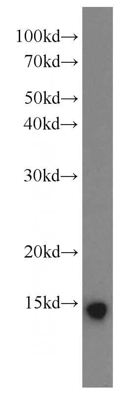 human brain tissue were subjected to SDS PAGE followed by western blot with Catalog No:113733(PFDN1 antibody) at dilution of 1:800