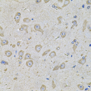 Immunohistochemistry - EIF3F Polyclonal Antibody 