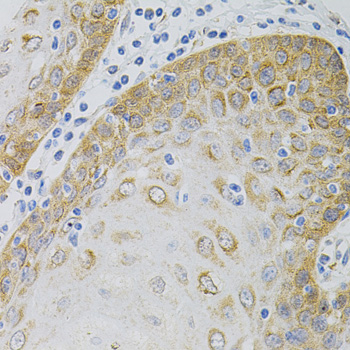 Immunohistochemistry - EEF1G Polyclonal Antibody 