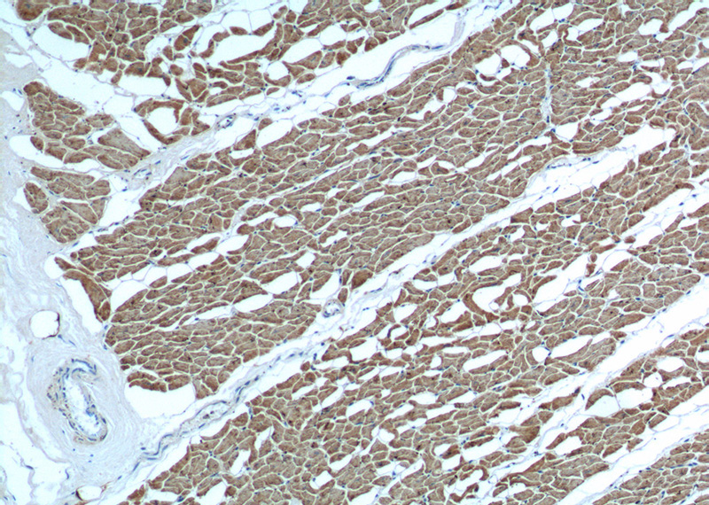 Immunohistochemistry of paraffin-embedded human heart tissue slide using Catalog No:112995(MYL2 Antibody) at dilution of 1:200 (under 10x lens)