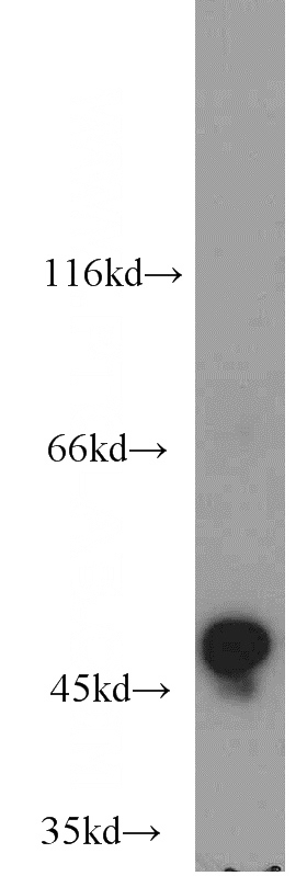 HEK-293 cells were subjected to SDS PAGE followed by western blot with Catalog No:107967(ALDH3A1 antibody) at dilution of 1:2000