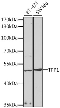 Western blot - TPP1 Polyclonal Antibody 