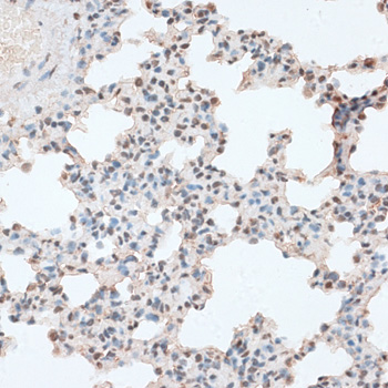 Immunohistochemistry - RBM17 Polyclonal Antibody 