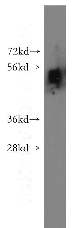 Y79 cells were subjected to SDS PAGE followed by western blot with Catalog No:109174(CDS2 antibody) at dilution of 1:500