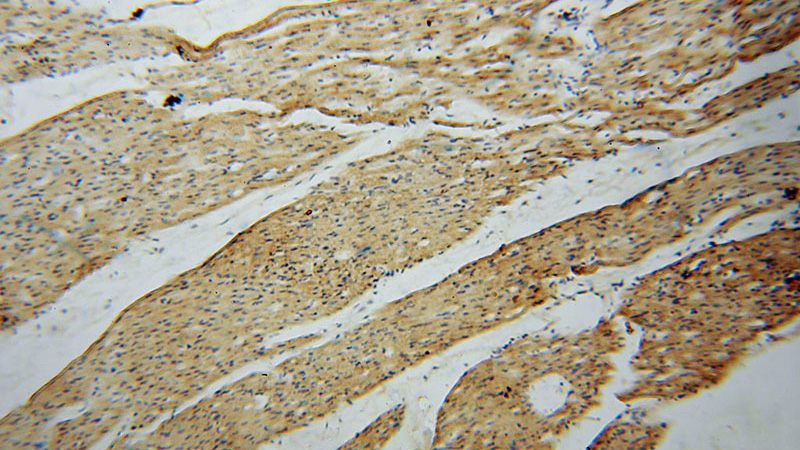 Immunohistochemical of paraffin-embedded human heart using Catalog No:107367(KMO antibody) at dilution of 1:50 (under 10x lens)