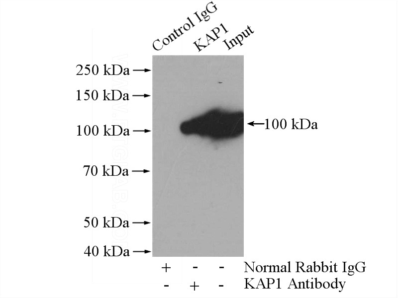 IP Result of anti-KAP1 (IP:Catalog No:111911, 4ug; Detection:Catalog No:111911 1:1000) with HeLa cells lysate 1200ug.