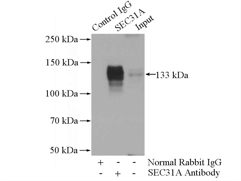 IP Result of anti-SEC31A (IP:Catalog No:115081, 4ug; Detection:Catalog No:115081 1:500) with HeLa cells lysate 1080ug.
