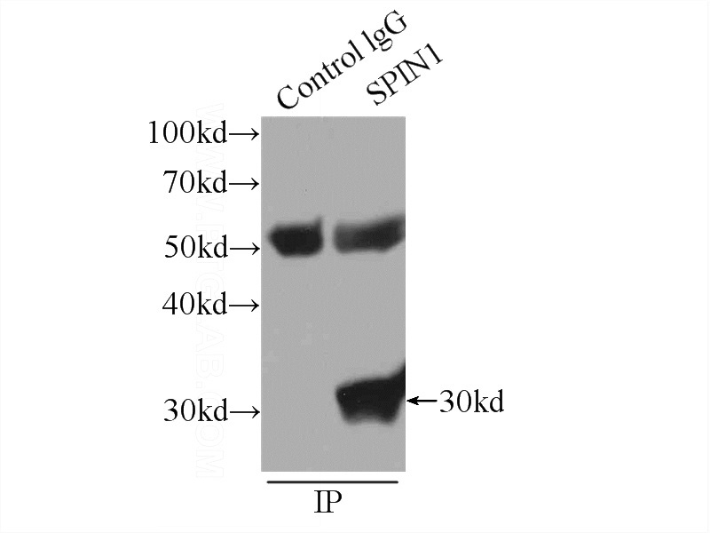 IP Result of anti-SPIN1 (IP:Catalog No:115570, 3ug; Detection:Catalog No:115570 1:800) with HeLa cells lysate 1840ug.