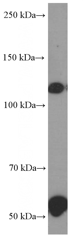 human retina tissue were subjected to SDS PAGE followed by western blot with Catalog No:107473(EGFLAM Antibody) at dilution of 1:1000