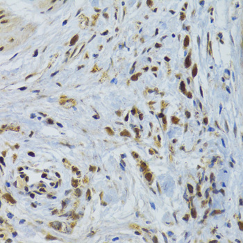Immunohistochemistry - GABPB1 Polyclonal Antibody 