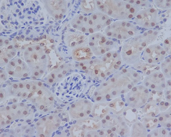 Immunohistochemical analysis of paraffin-embedded mouse kidney, using ATF4 Antibody.