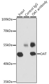 Immunoprecipitation - OAT Polyclonal Antibody 