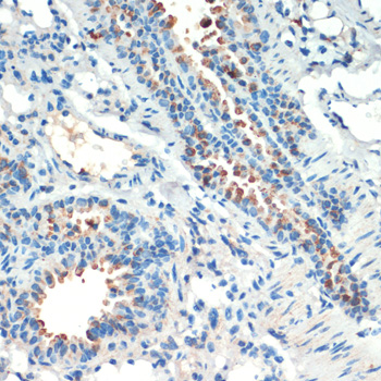 Immunohistochemistry - RPS6KA4 Polyclonal Antibody 