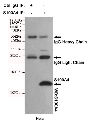 Immunoprecipitation analysis of Hela cell lysates using S100A4 mouse mAb.