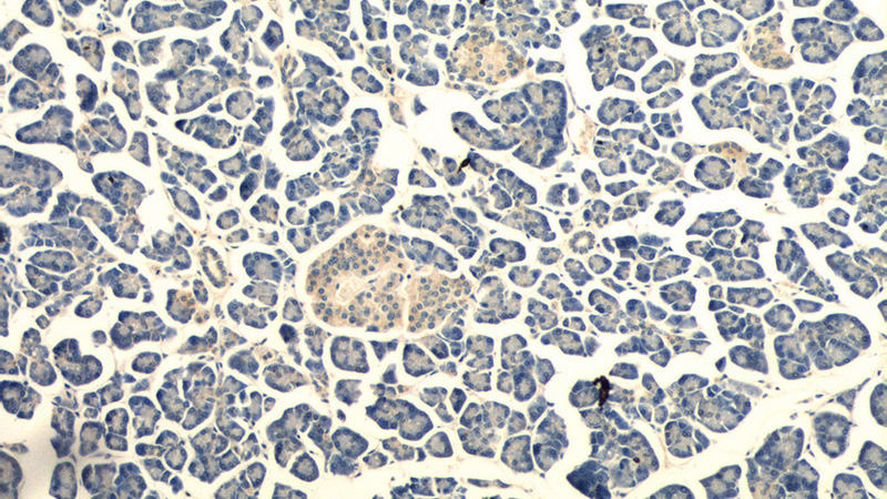 Immunohistochemistry of paraffin-embedded human pancreas tissue slide using Catalog No:110916(G-CSF Antibody) at dilution of 1:50 (under 10x lens)