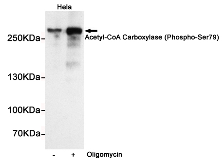 Western blot detection of Acetyl-CoA Carboxylase (Phospho-Ser79) in Hela cells untreated or treated with Oligomycin using Acetyl-CoA Carboxylase (Phospho-Ser79) Rabbit pAb (dilution 1:500).Predicted band size:280kDa.Observed band size:280kDa.