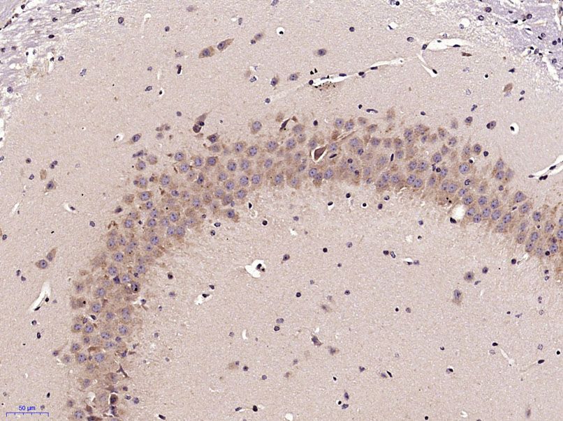 Fig3: Paraformaldehyde-fixed, paraffin embedded (Mouse brain); Antigen retrieval by microwave in sodium citrate buffer (pH6.0) ; Block endogenous peroxidase by 3% hydrogen peroxide for 30 minutes; Blocking buffer (3% BSA) at RT for 30min; Antibody incubation with (ECE2) Polyclonal Antibody, Unconjugated at 1:400 overnight at 4℃, followed by conjugation to the secondary antibody (labeled with HRP)and DAB staining.