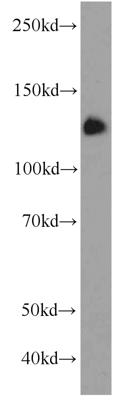 mouse brain tissue were subjected to SDS PAGE followed by western blot with Catalog No:116103(TMEM168 antibody) at dilution of 1:1000
