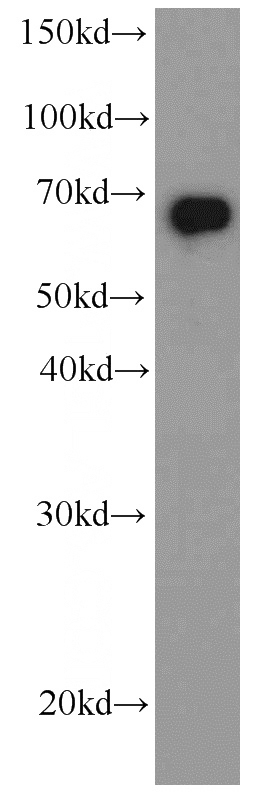 HeLa cells were subjected to SDS PAGE followed by western blot with Catalog No:107257(HDAC1 antibody) at dilution of 1:4000