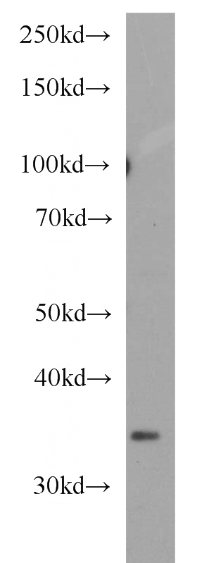 HeLa cells were subjected to SDS PAGE followed by western blot with Catalog No:112192(LEFTY2 antibody) at dilution of 1:500