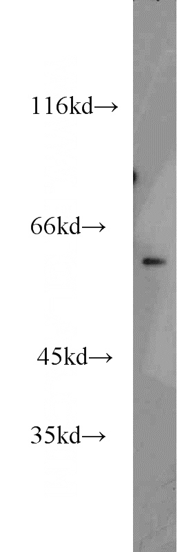 mouse kidney tissue were subjected to SDS PAGE followed by western blot with Catalog No:113196(Naked2 antibody) at dilution of 1:400