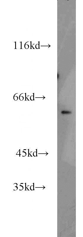 mouse kidney tissue were subjected to SDS PAGE followed by western blot with Catalog No:113196(Naked2 antibody) at dilution of 1:400
