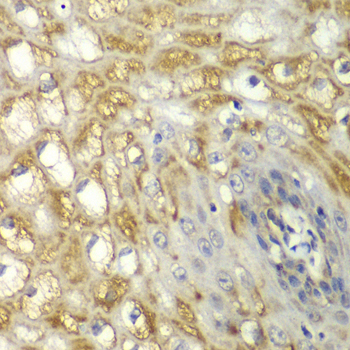 Immunohistochemistry - MYO1C Polyclonal Antibody 