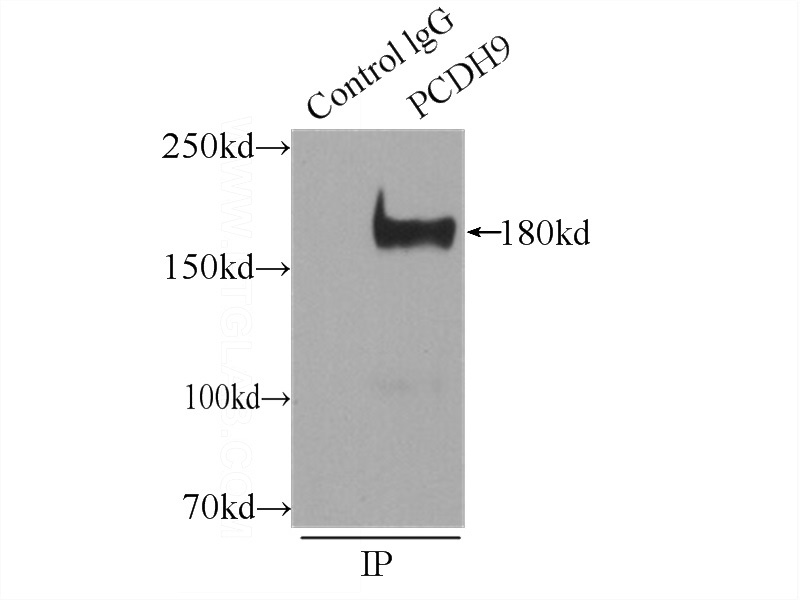 IP Result of anti-PCDH9 (IP:Catalog No:113692, 4ug; Detection:Catalog No:113692 1:1000) with mouse brain tissue lysate 5000ug.