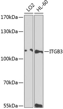 Western blot - ITGB3 Polyclonal Antibody 