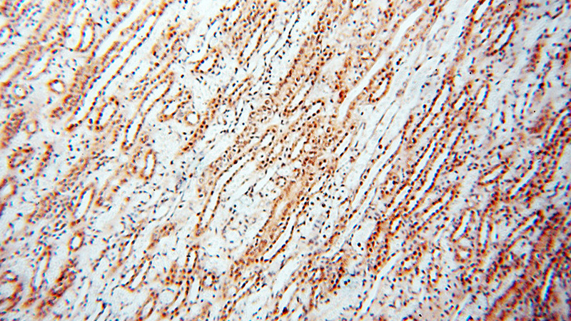 Immunohistochemical of paraffin-embedded human kidney using Catalog No:116593(USP16 antibody) at dilution of 1:100 (under 10x lens)