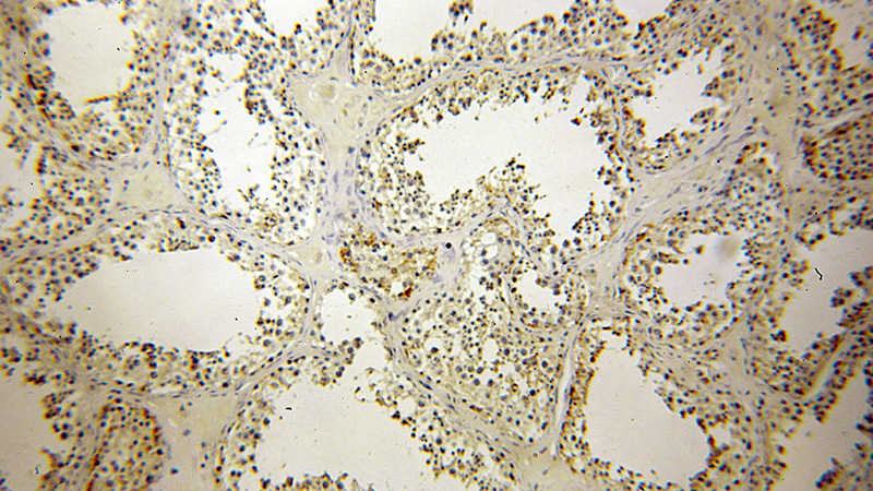 Immunohistochemical of paraffin-embedded human testis using Catalog No:109677(CYLC2 antibody) at dilution of 1:100 (under 10x lens)