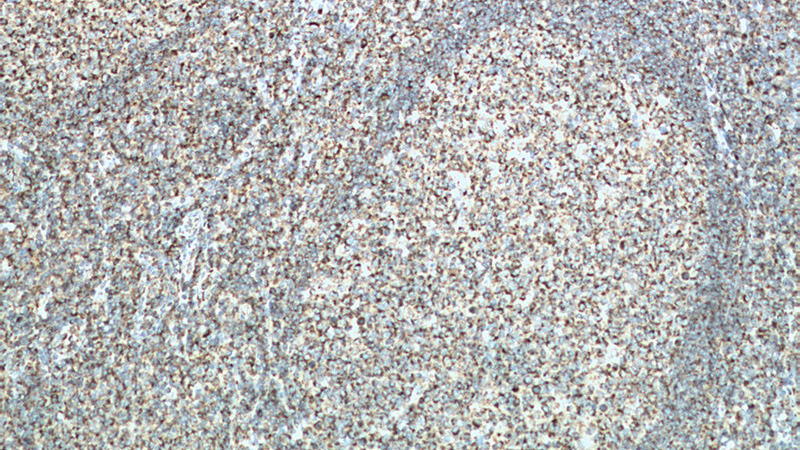 Immunohistochemistry of paraffin-embedded human tonsillitis tissue slide using Catalog No:115295(SLAMF6 Antibody) at dilution of 1:200 (under 10x lens). heat mediated antigen retrieved with Tris-EDTA buffer(pH9).