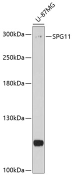 Western blot - SPG11 Polyclonal Antibody 