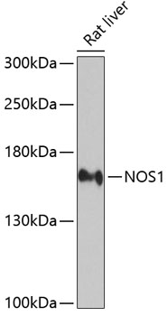 Western blot - NOS1 Polyclonal Antibody 