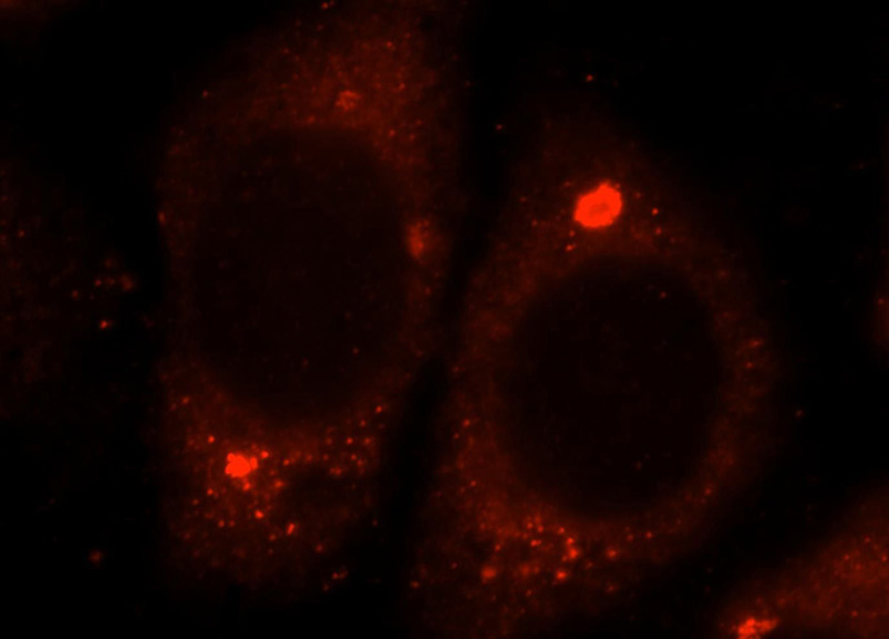 Immunofluorescent analysis of HepG2 cells, using UGT2B7 antibody Catalog No:111226 at 1:25 dilution and Rhodamine-labeled goat anti-rabbit IgG (red).