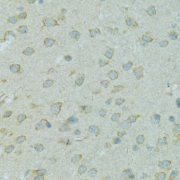 Immunohistochemistry - CYP2B6 Polyclonal Antibody 