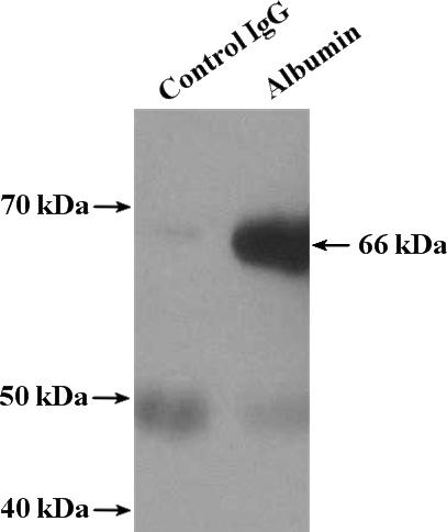 IP Result of anti-Albumin (IP:Catalog No:107955, 4ug; Detection:Catalog No:107955 1:10000) with human plasma tissue lysate 4000ug.