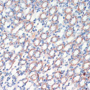 Immunohistochemistry - LRRK2 Polyclonal Antibody 