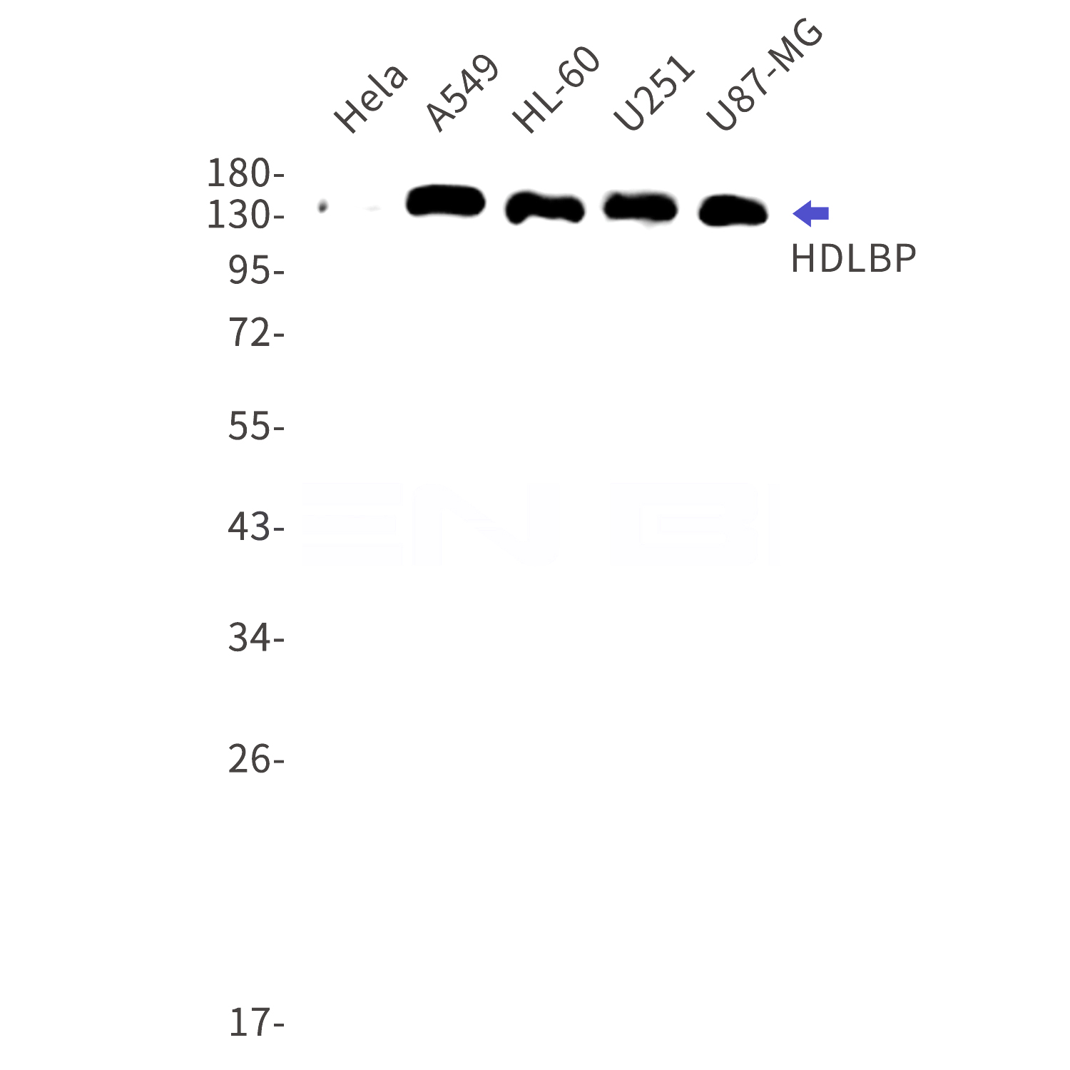 Western blot detection of HDLBP in Hela,A549,HL-60,U251,U87-MG cell lysates using HDLBP Rabbit mAb(1:1000 diluted).Predicted band size:142kDa.Observed band size:142kDa.