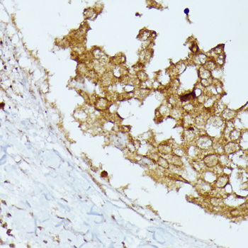 Immunohistochemistry - CD168 Polyclonal Antibody 
