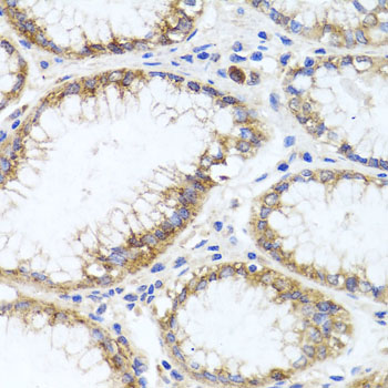 Immunohistochemistry - GPM6A Polyclonal Antibody 